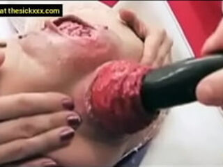 Extreme prolapse fucking with a dildo