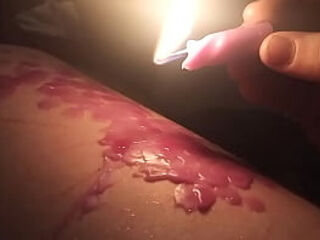 Wax play (Purple) - Masochist transman drips Hot wax on thick thigh while wearing knee thighs