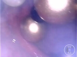 CAM INSIDE ASS: Ball Chain disappears deep in her hole